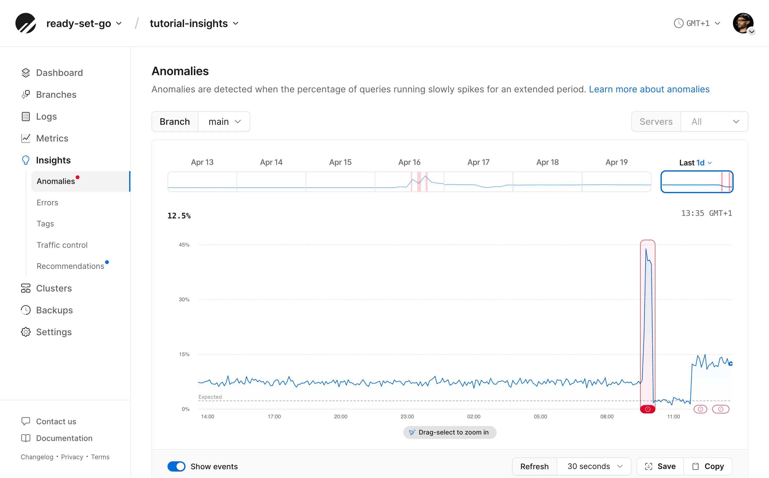 Insights anomalies page
